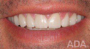 Beautiful Smile — Hudsonville, MI — Hudsonville Family Dentistry