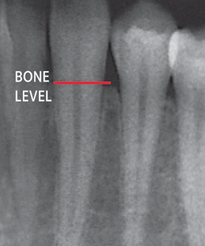 Dental X-ray — Hudsonville, MI — Hudsonville Family Dentistry