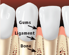 Gums, Ligament And Bone — Hudsonville, MI — Hudsonville Family Dentistry