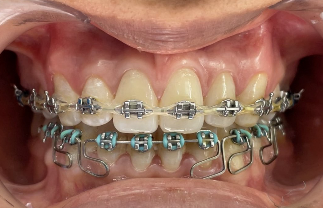 ORTODONCIA Y ORTOPEDIA MAXILAR