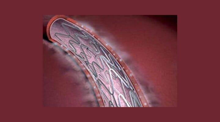 DR JESÚS ROBERTO RIVERO GALLEGOS - SOPLOS