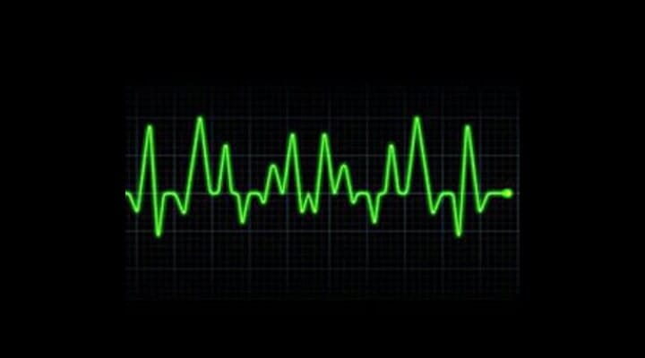 DR JESÚS ROBERTO RIVERO GALLEGOS - ARRITMIAS