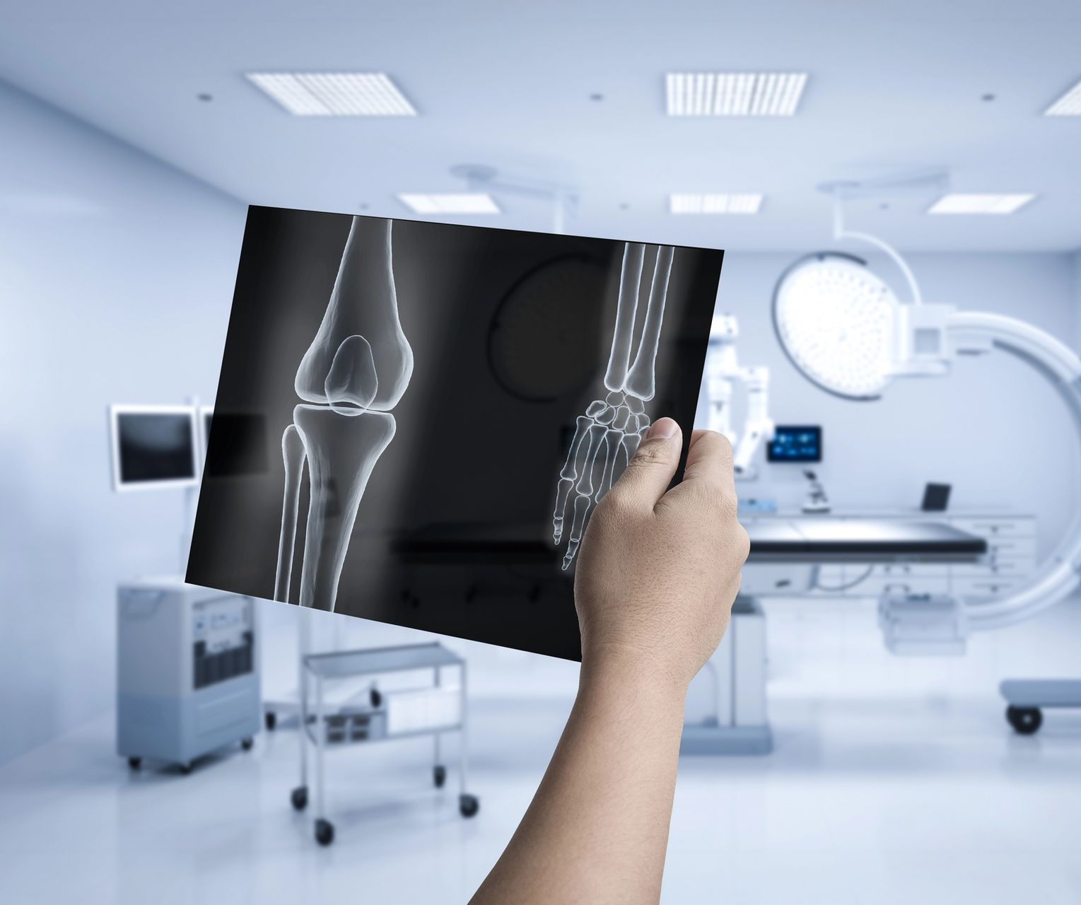 Un computer portatile su una scrivania mostra le immagini radiografiche di un piede e di una mano in una luminosa e sterile sala di diagnostica per immagini.