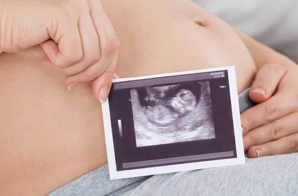 A pregnant woman is holding an ultrasound picture of her baby.