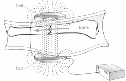 A black and white drawing of a coil and a bone.