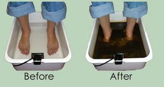 A before and after picture of a person 's feet in a foot bath.