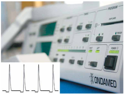 A kondamed device with a picture of a heartbeat next to it