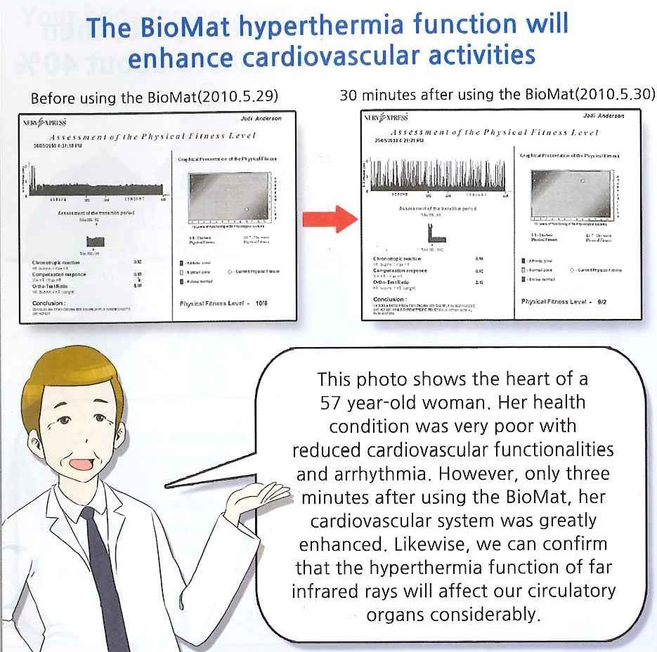 A cartoon of a doctor talking about the biomat hyperthermia function