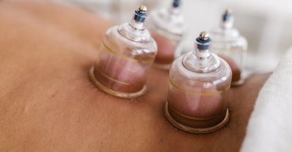 A person is getting cupping treatment on their back.