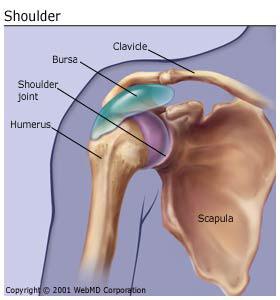 Bursitis