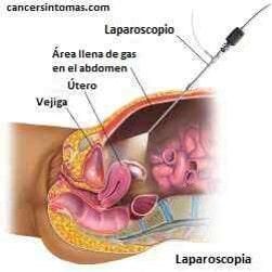 HERNANDEZ PEREZ DAVID DR. - Cirugía laparoscópica