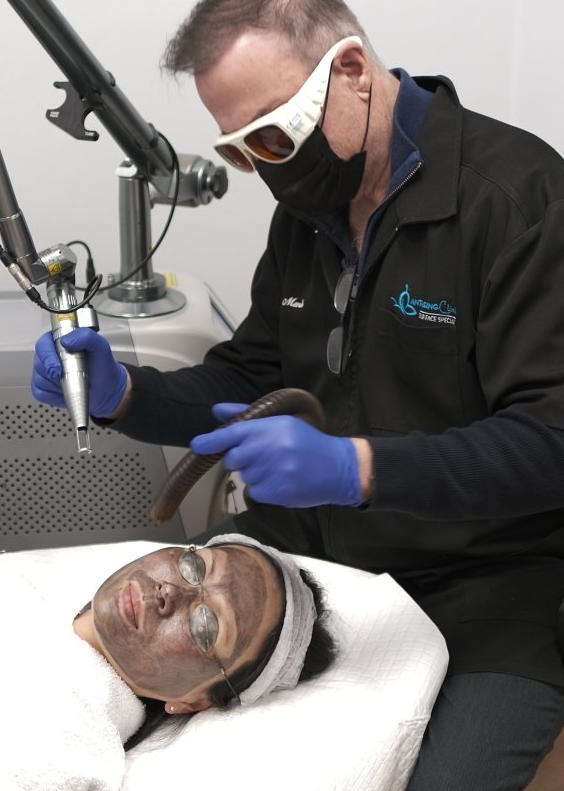 specialist applying carbon facial peel