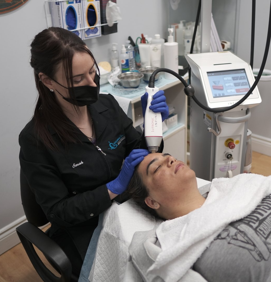 client receiving radiofrequency microneedling treatment