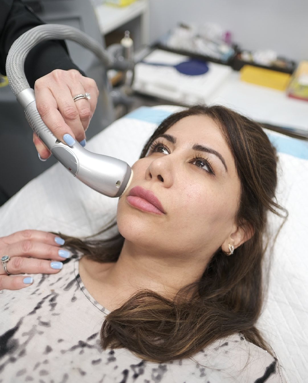 patient receiving Radio Frequency facial treatment with infini machine