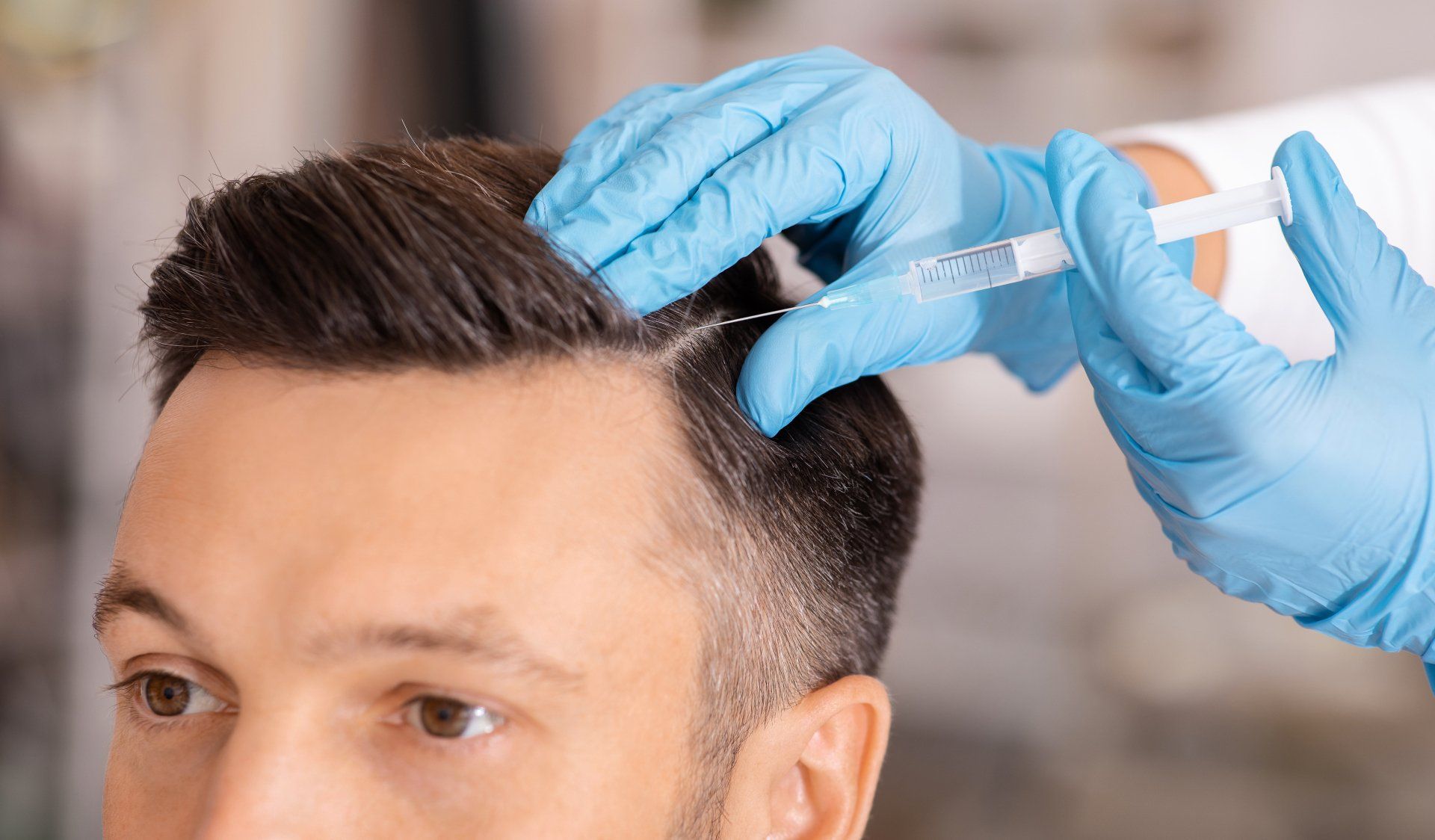 man getting mesotherapy to scalp