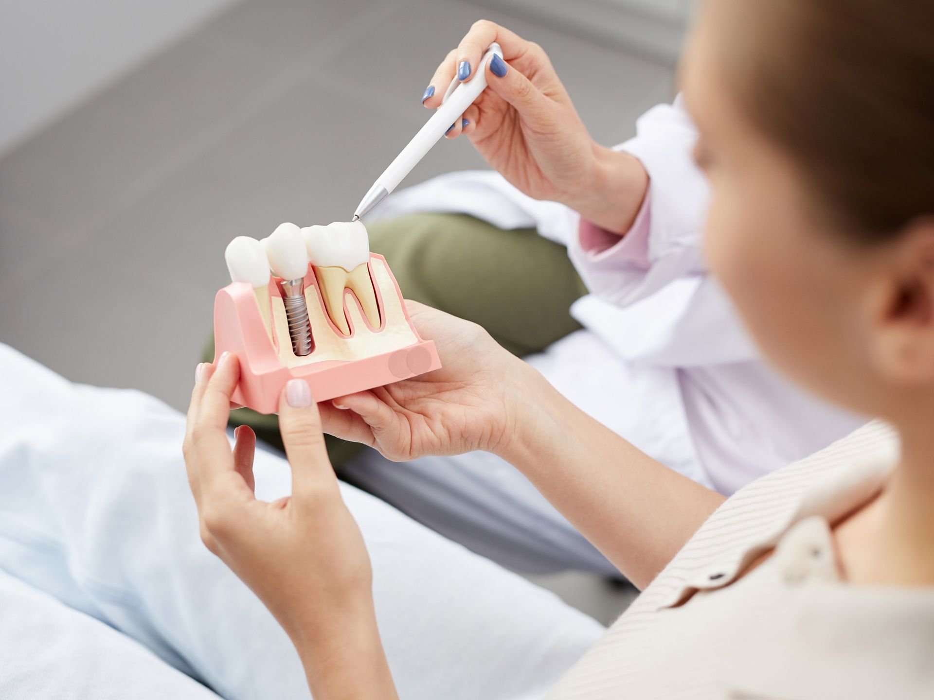 Eine Frau hält ein Modell von Zahnimplantaten in ihren Händen und erhält eine Implantat-Beratung von einer implantologischen Zahnärztin.