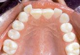 A close up of a person 's mouth with white teeth.
