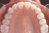 A close up of a person 's mouth with white teeth.