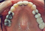 A close up of a person 's mouth with a lot of teeth.