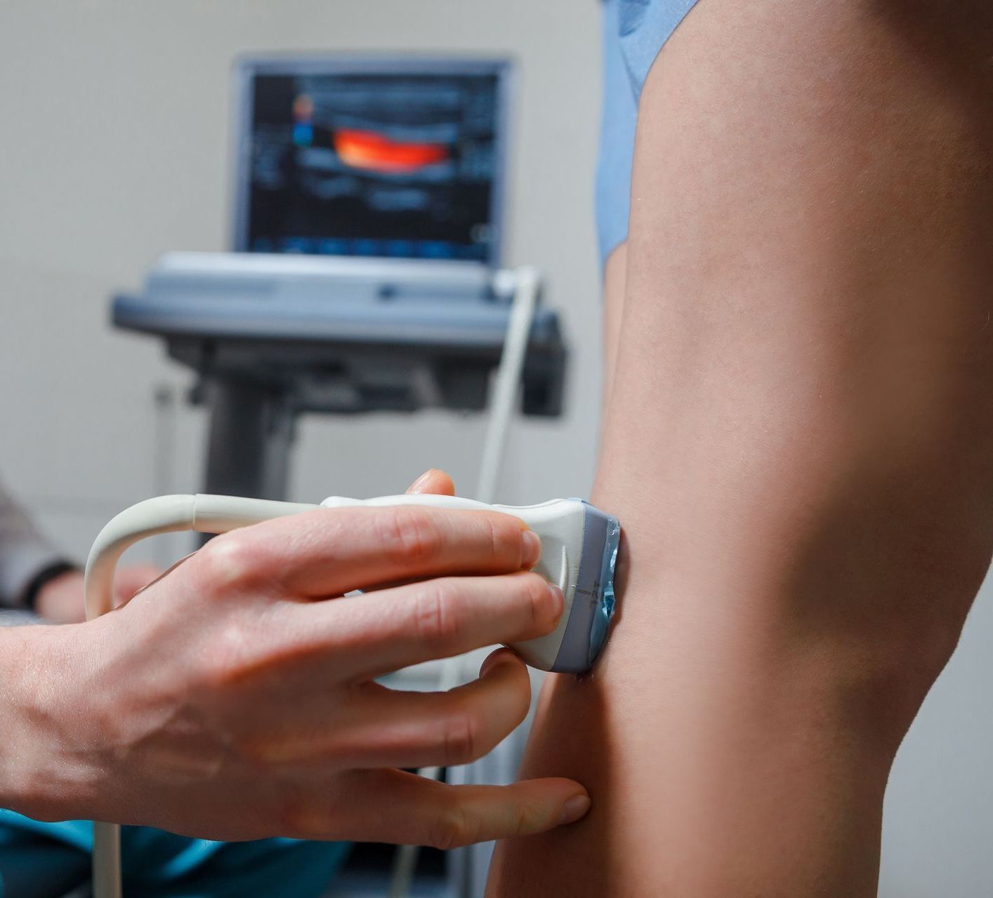 ultrasound on patient's leg veins in a clinic