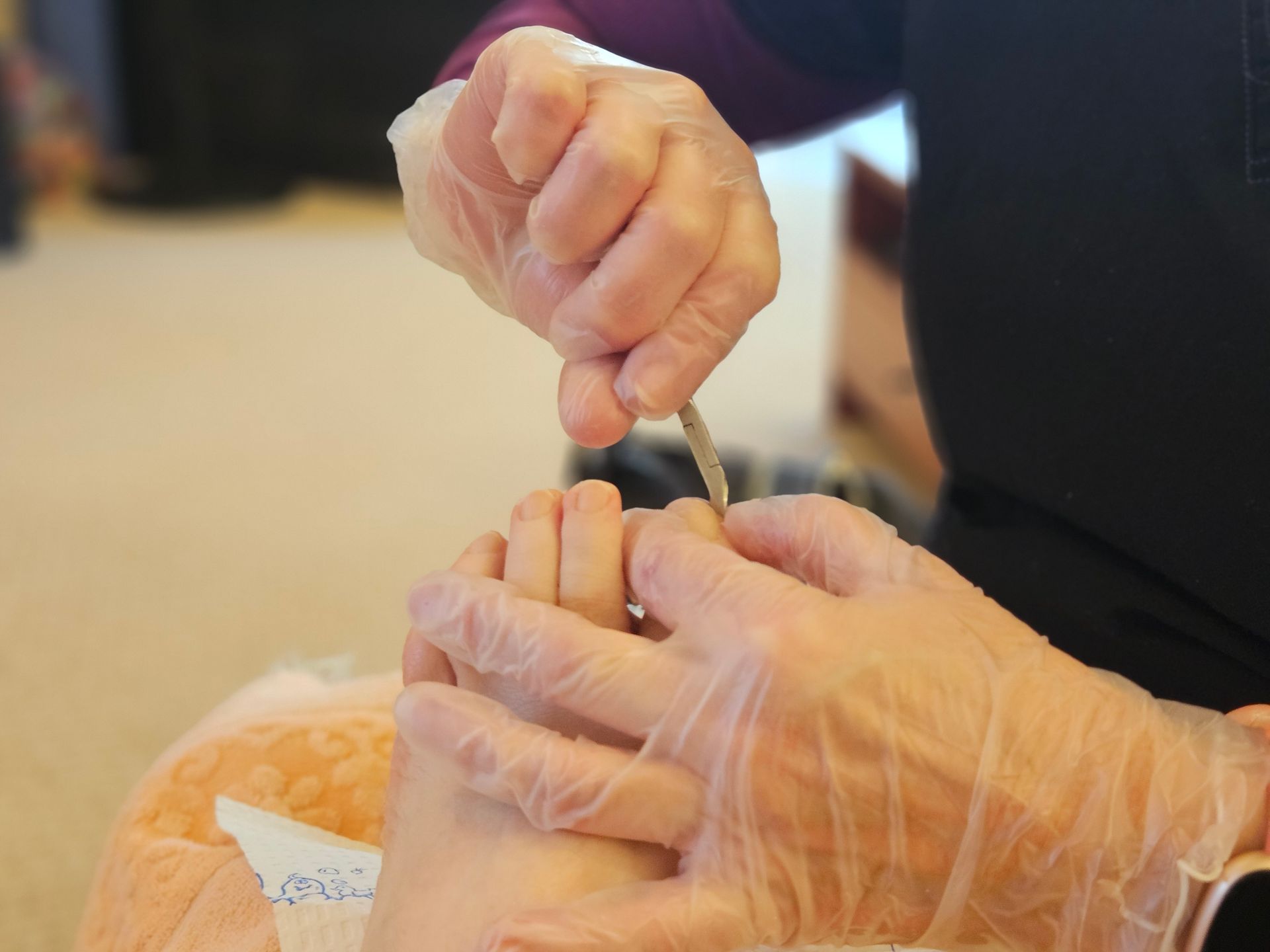 A person wearing clear plastic gloves uses a small metal tool to carefully work on a toenail during a procedure.