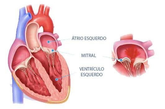 Diagrama de um coração humano em corte transversal, com legendas indicando o átrio esquerdo, a valva mitral e o ventrículo esquerdo.