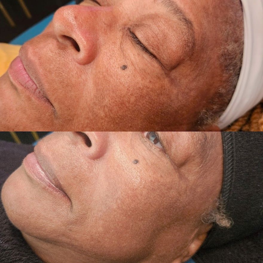 Comparison of a person's face. Top: skin appears darker. Bottom: skin appears lighter.