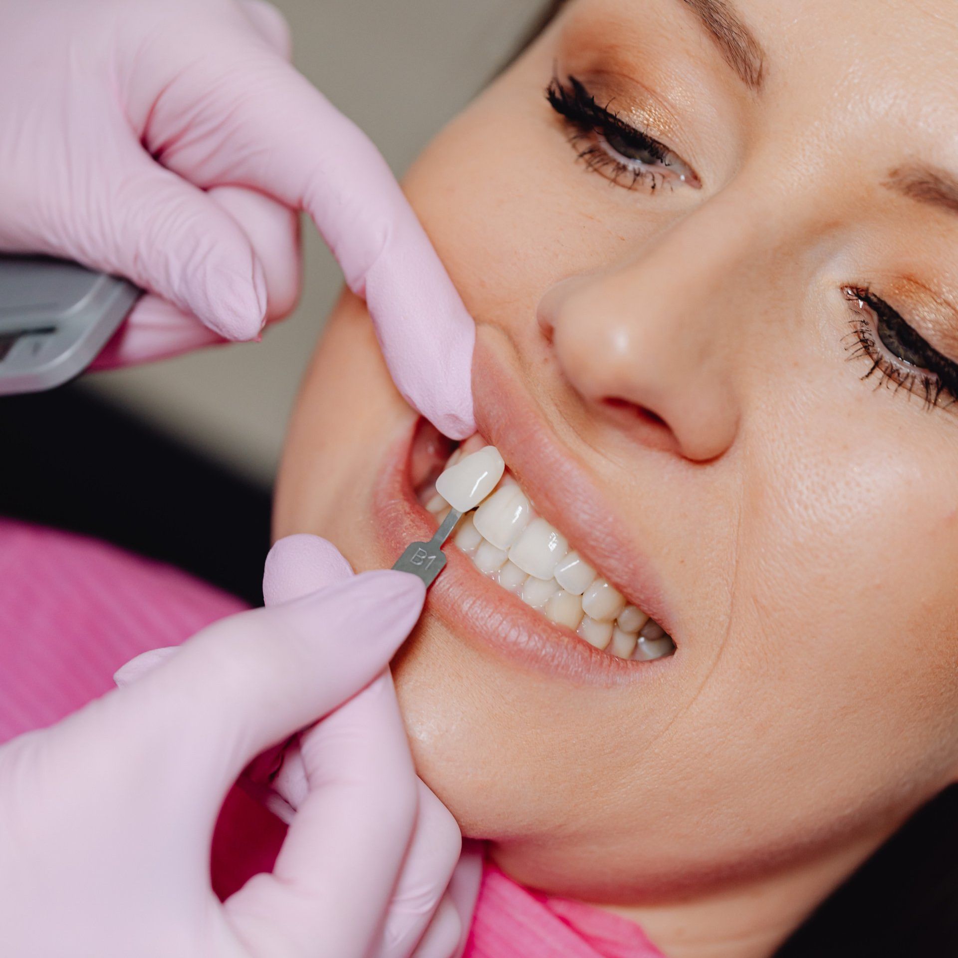 A woman is getting her teeth whitened by a dentist.