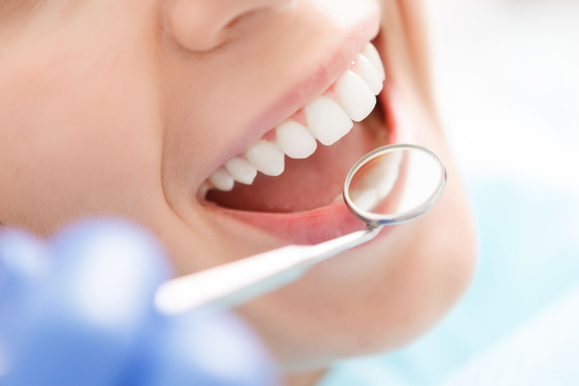 Close-up of a woman having her teeth examined by a preventive dentist at a clinic.