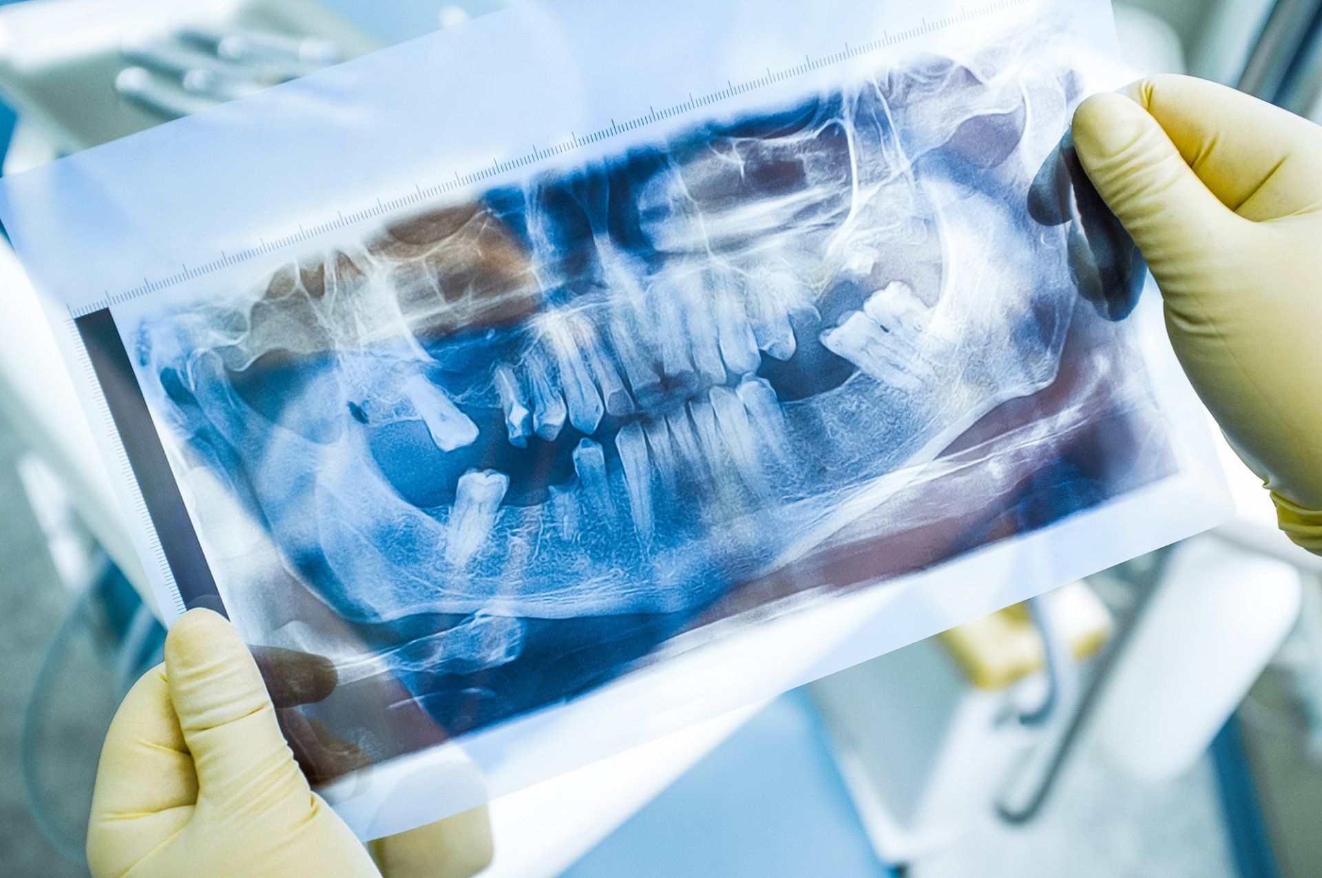 A dentist is holding an x-ray of a person 's teeth.