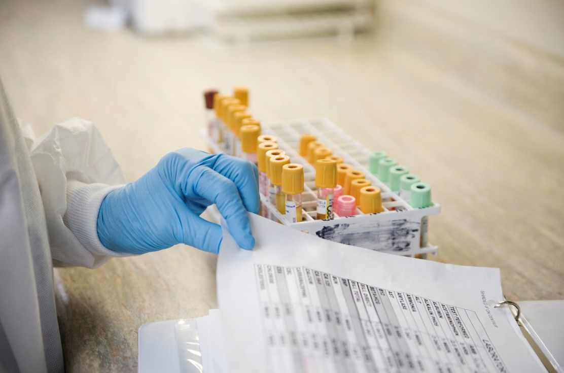 esami di laboratorio di autoanalisi Milano