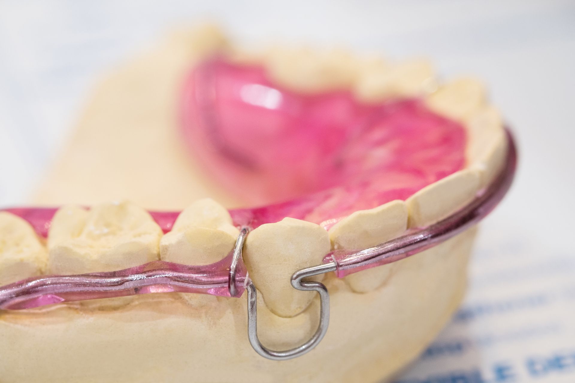 Pink retainer on a dental mold, showing teeth, wire, and plastic.