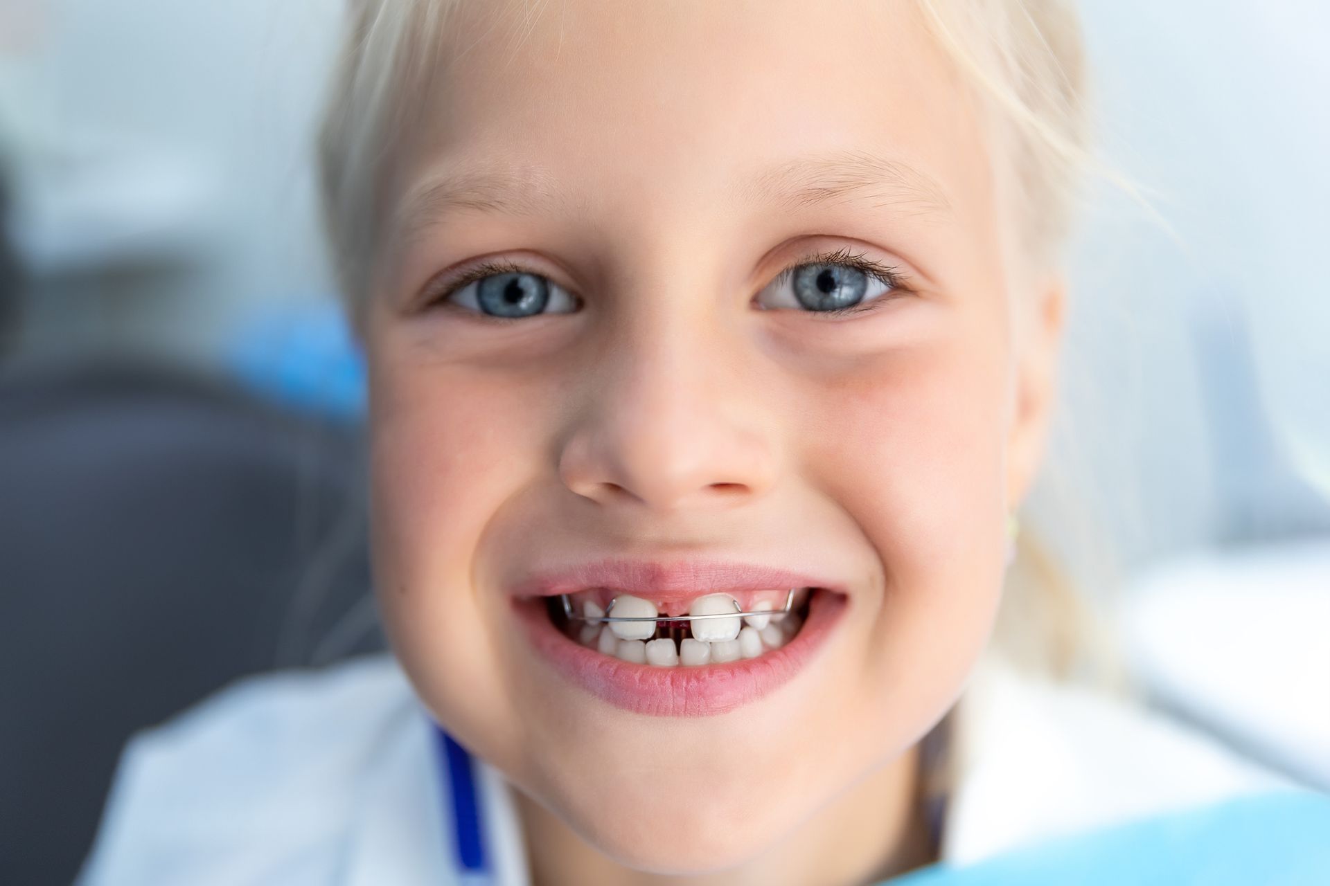 Blonde girl smiles, showing missing front teeth. Blue eyes, white shirt.