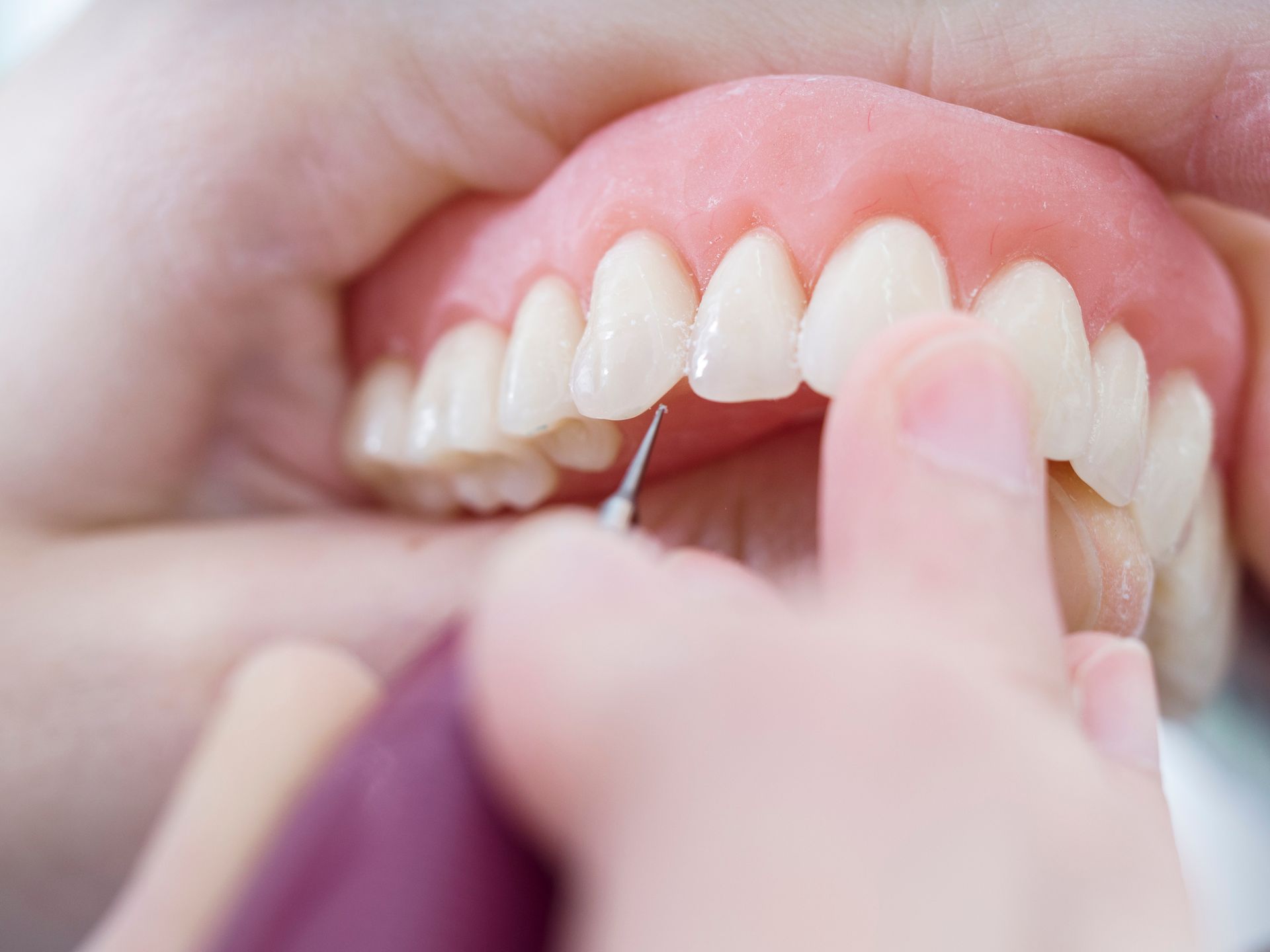 A person's hand polishing a set of dentures with a small tool.