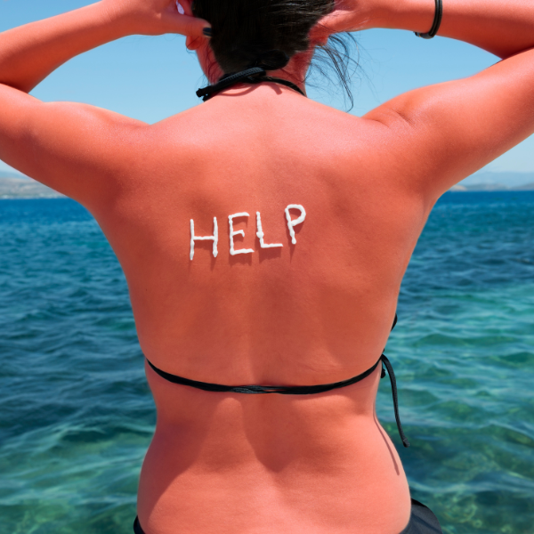 Sandstone Therapeutic Massage / A woman's back is sunburned and has HALP written on her back.