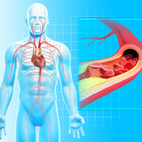 Sandstone Therapeutic Massage / A picture of a body showing the heart and blood vessels. 