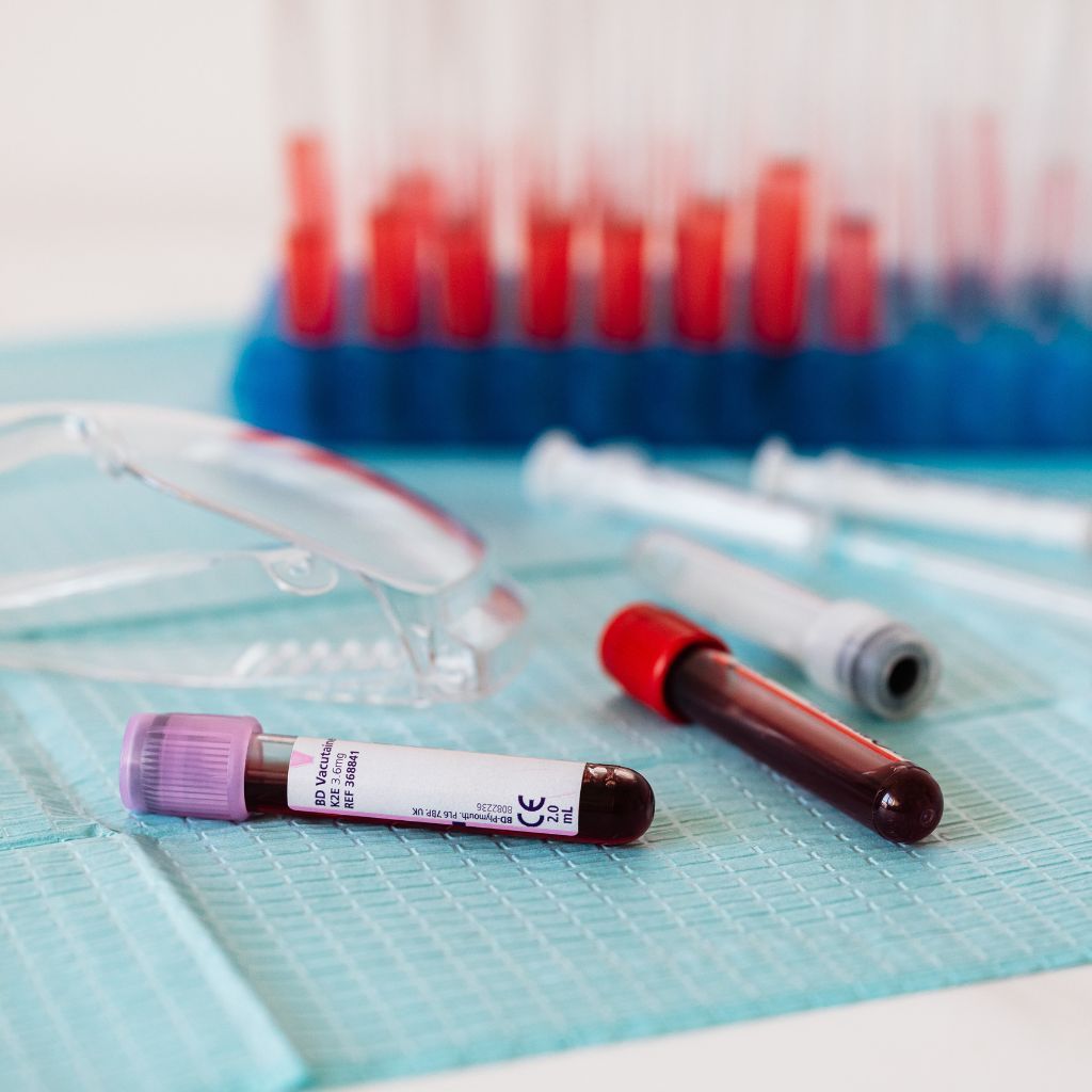 Blood sample tubes and medical supplies on a blue surface.