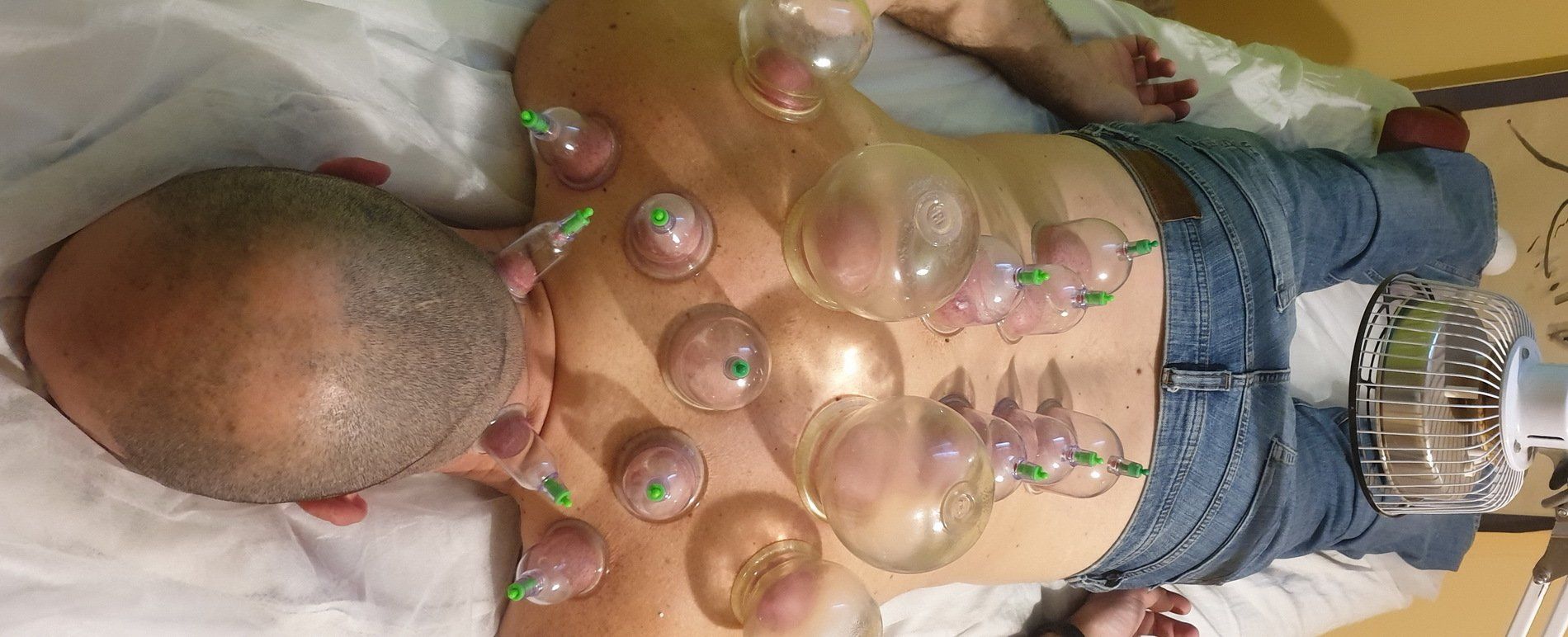 טיפול בכוסות רוח