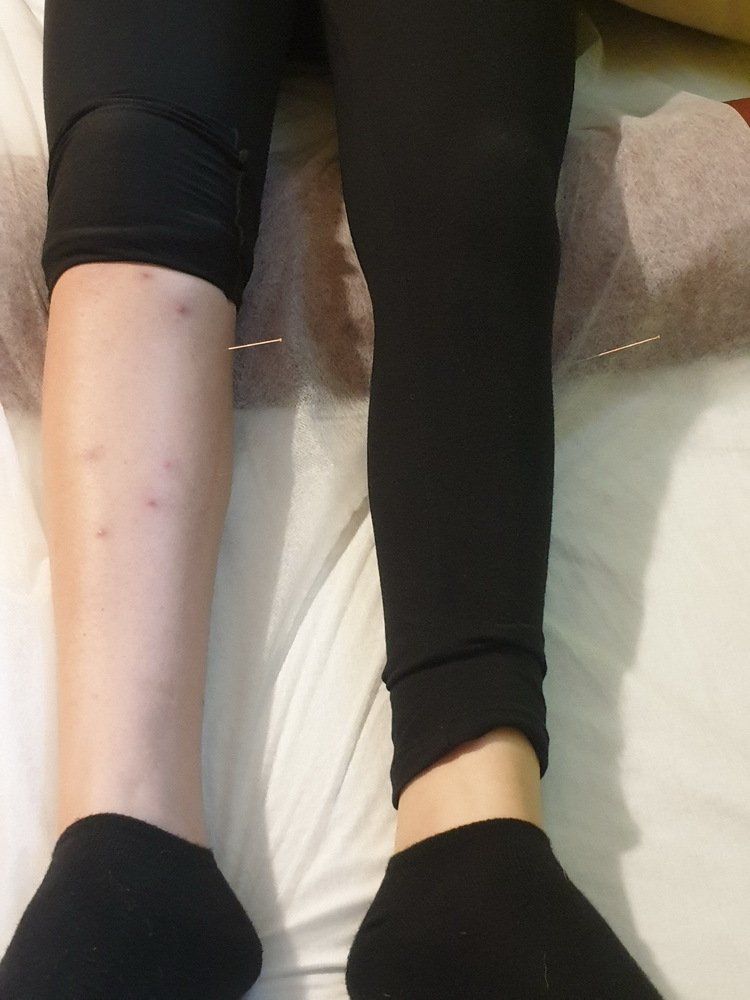 אדם שוכב על מיטה לבוש בטייץ שחור וגרביים שחורות