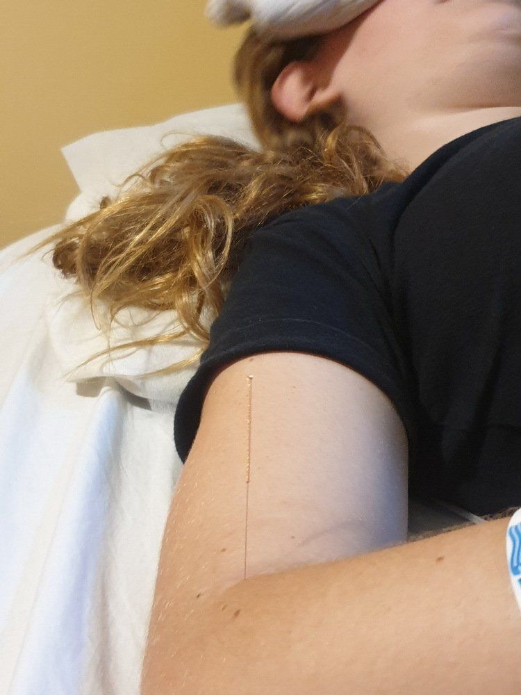 אישה שוכבת על מיטה עם מחט בזרועה