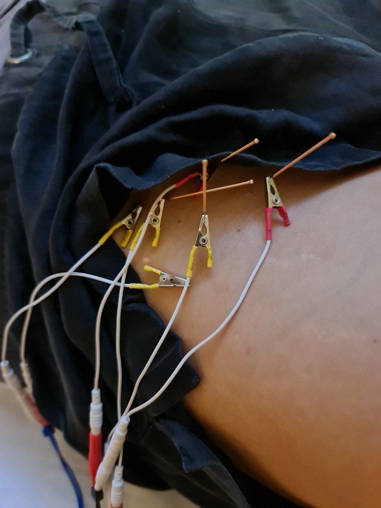 לאדם יש חבורה של חוטים מחוברים לגב שלו