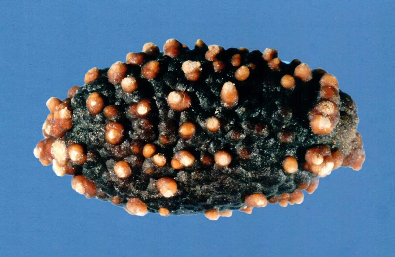 Technologists at our reference laboratory possess decades of experience in examining kidney stones. We have specialized in stone analysis for over 45 years.