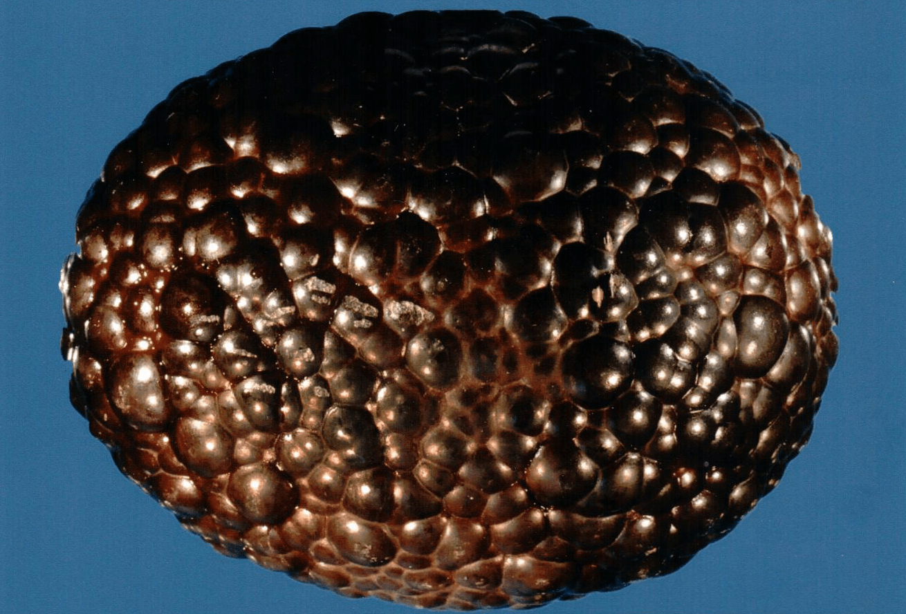 Technologists at our reference laboratory possess decades of experience in examining kidney stones. We have specialized in stone analysis for over 45 years.