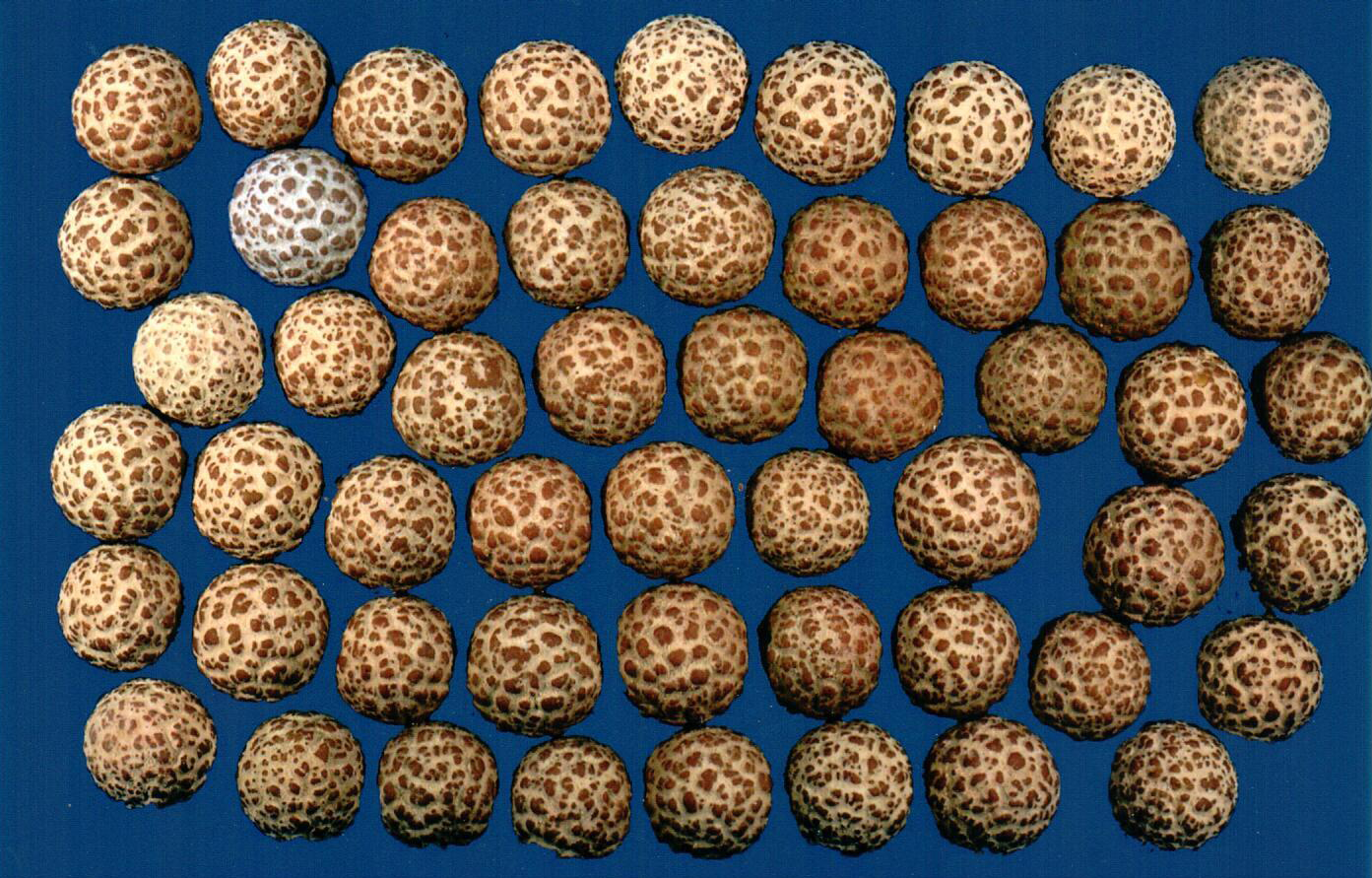 Technologists at our reference laboratory possess decades of experience in examining kidney stones. We have specialized in stone analysis for over 45 years.