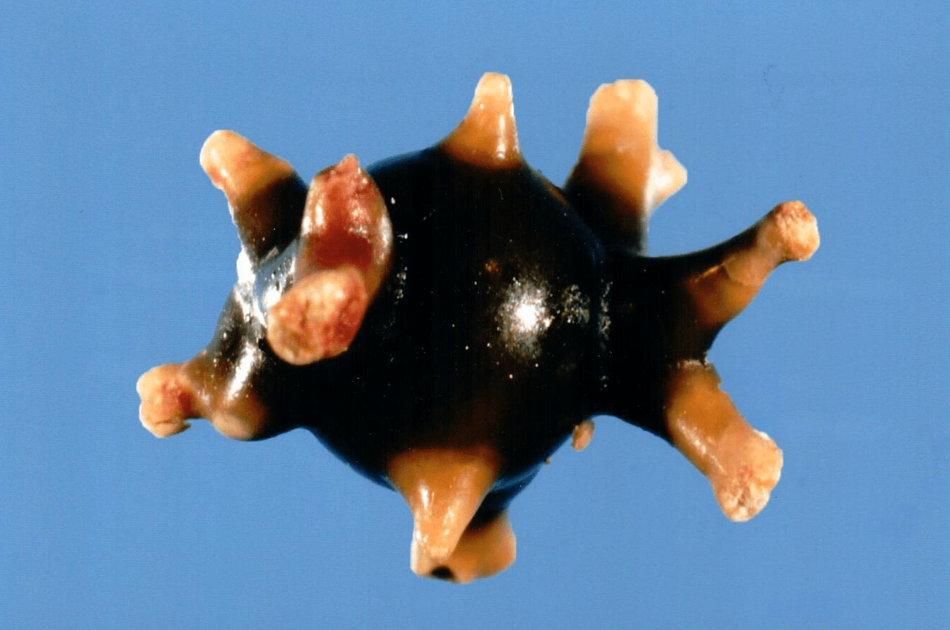 Technologists at our reference laboratory possess decades of experience in examining kidney stones. We have specialized in stone analysis for over 45 years.