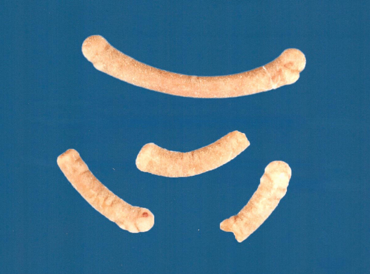 Technologists at our reference laboratory possess decades of experience in examining kidney stones. We have specialized in stone analysis for over 45 years.