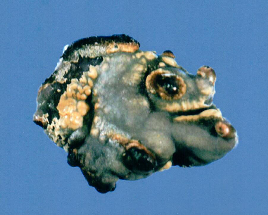 Technologists at our reference laboratory possess decades of experience in examining kidney stones. We have specialized in stone analysis for over 45 years.