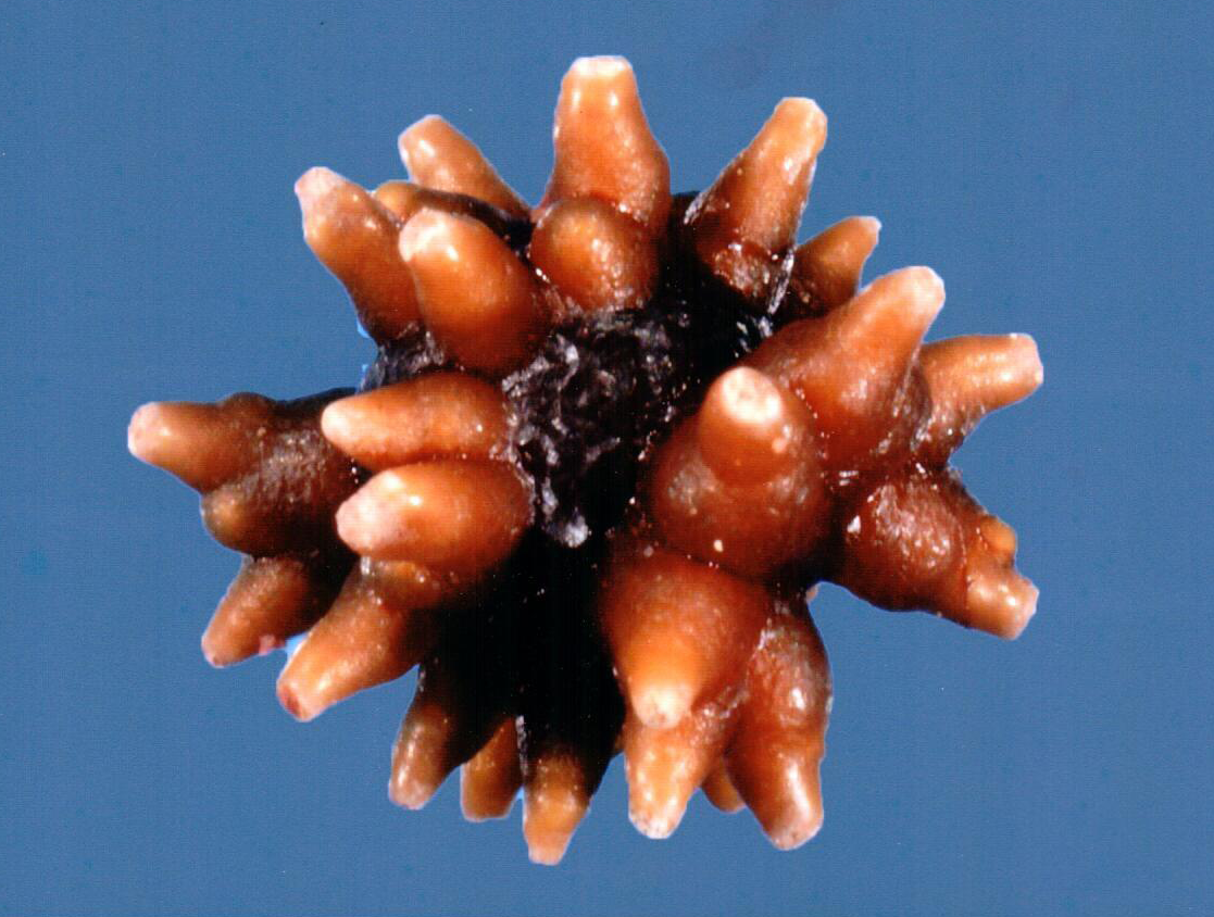 Technologists at our reference laboratory possess decades of experience in examining kidney stones. We have specialized in stone analysis for over 45 years.