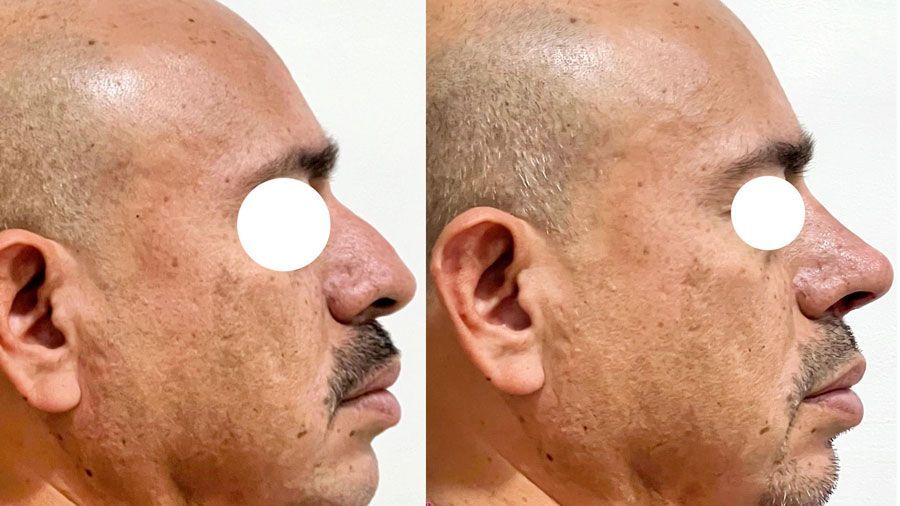 Dr. Fernando Vázquez - NARTIZ