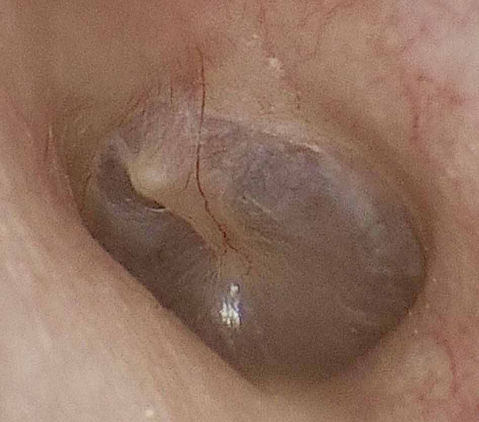 Dr. Fernando Vázquez - RINOPLASTIA